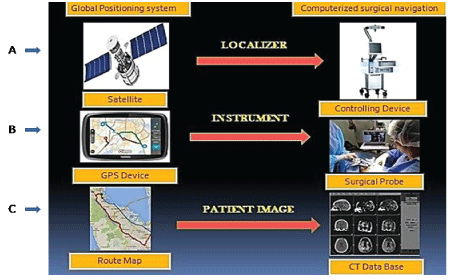 Navigation Array Medical Device Surgical Navigation in Oral and Maxillofacial Surgery: A Review
