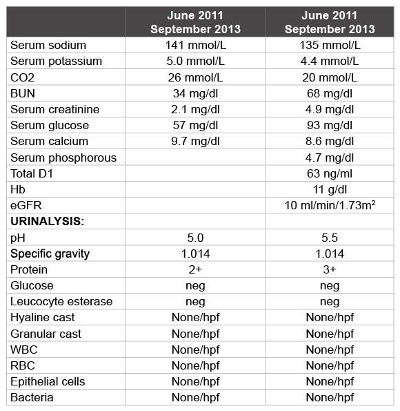 A Curious Case of Fabry’s Disease Delayed Renal Presentation